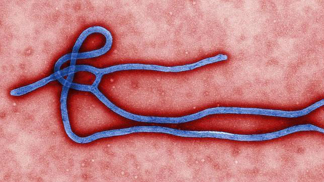 Qué es el ébola y sus consecuencias?
